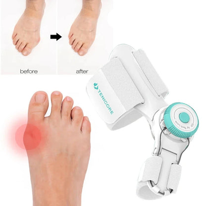 Bunion Corrector